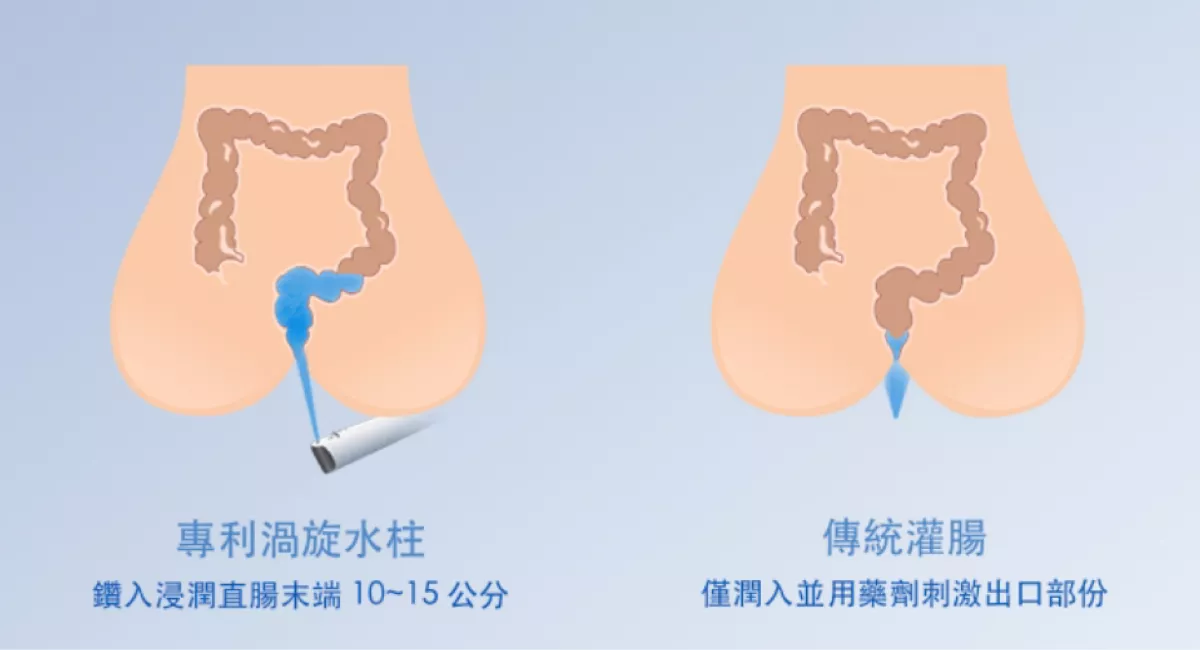ppspa,馬桶,免治馬桶,便秘